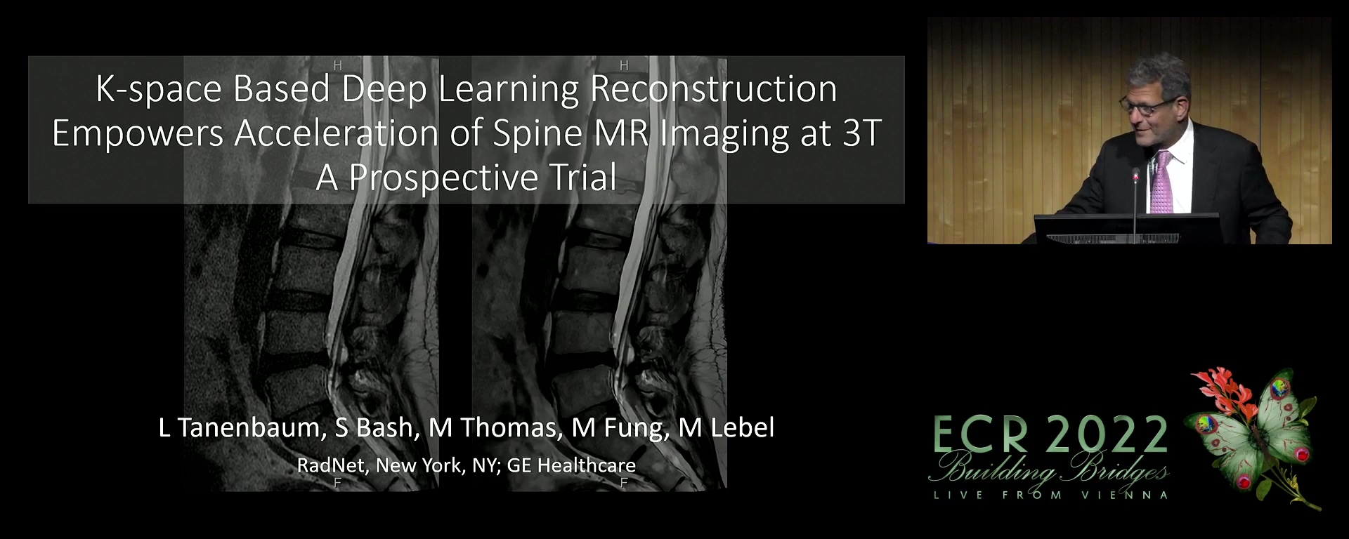 K-space based deep learning reconstruction empowers 50% acceleration of MR spine imaging: a prospective multicentre, multireader trial