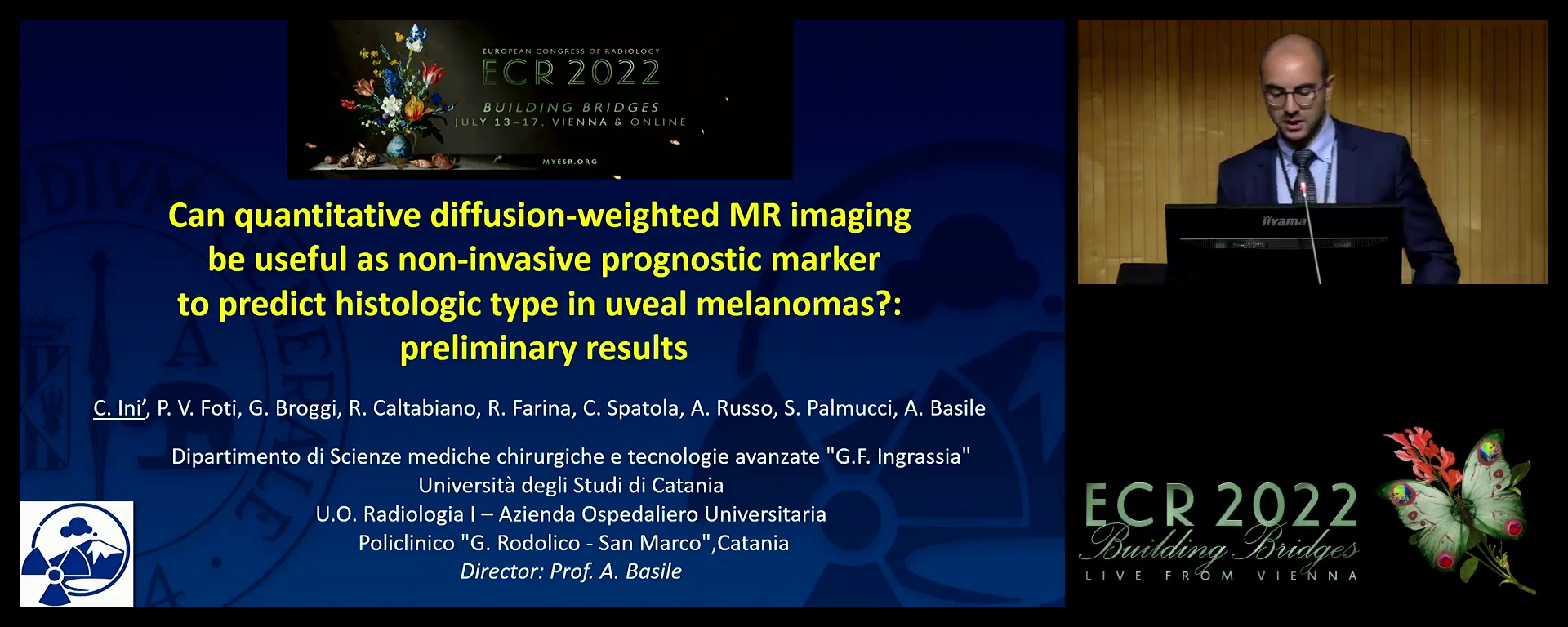 Can quantitative diffusion-weighted MR imaging be useful as non-invasive prognostic marker to predict histologic type in uveal melanomas?: preliminary results