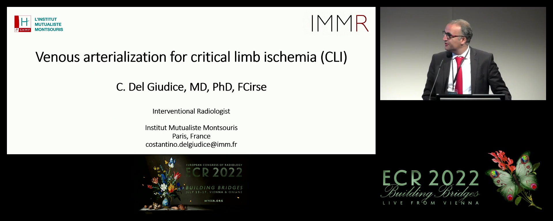 Venous arterialisation for critical limb ischaemia (CLI) - Costantino Del Giudice, Paris / FR