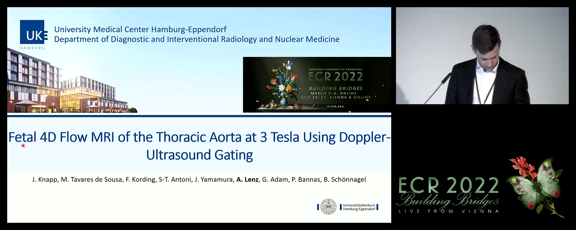 Fetal 4D flow MRI of the thoracic aorta at 3 Tesla using Doppler-ultrasound gating - Alexander Lenz, Hamburg / DE