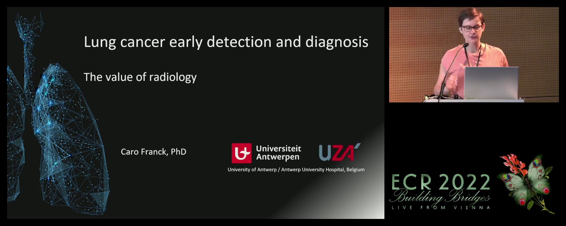 Lung cancer early detection and diagnosis: the value of radiology - Caro Franck, Edegem / BE