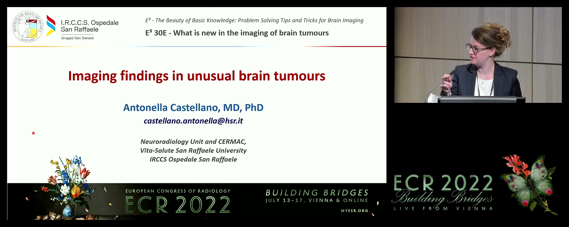 Imaging findings in unusual brain tumours