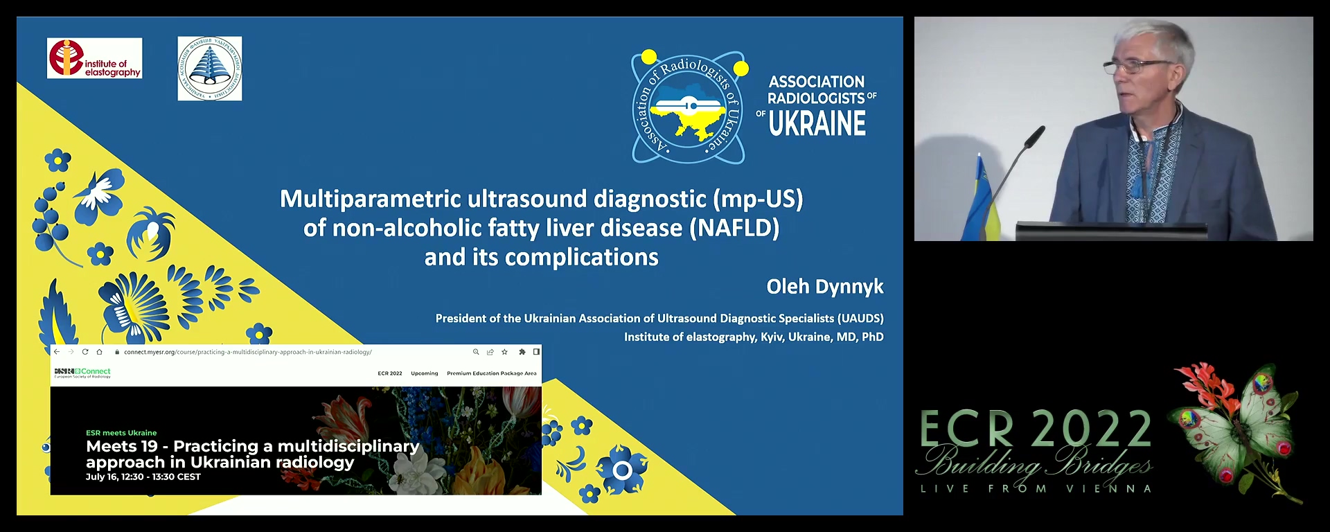 Multiparametric ultrasound diagnostic (mp-US) of non-alcoholic fatty liver disease (NAFLD) and ist complications