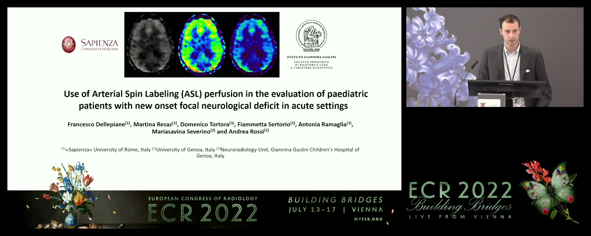 Use of arterial spin labelling (ASL) perfusion in the evaluation of paediatric patiens with new onset focal neurological deficit in acute settings - Francesco Dellepiane, Rome / IT