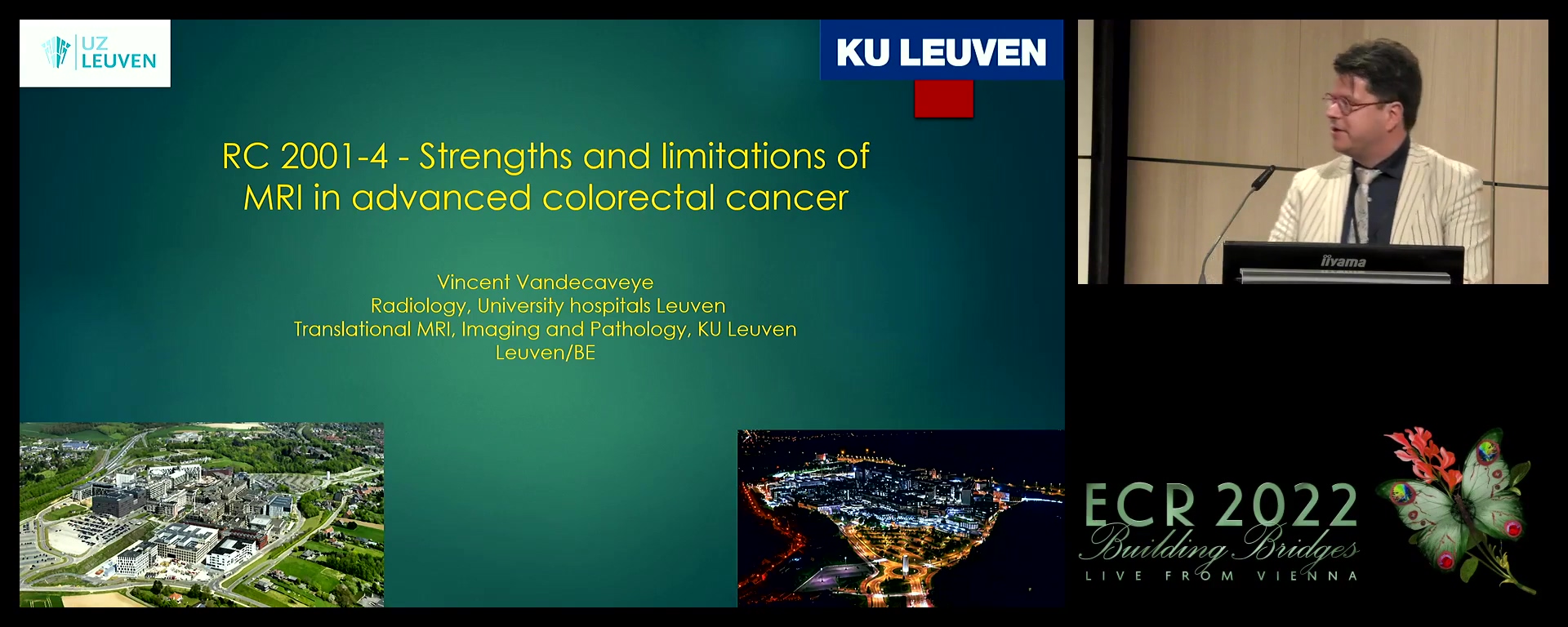 Strengths and limitations of MRI in advanced colorectal cancer - Vincent Vandecaveye, Leuven / BE