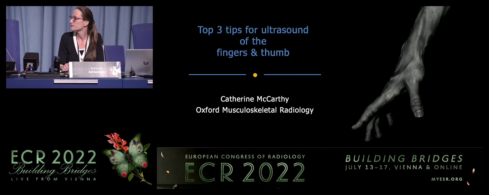 My top three tips for ultrasound of the fingers and thumb - Catherine McCarthy, Oxford / UK