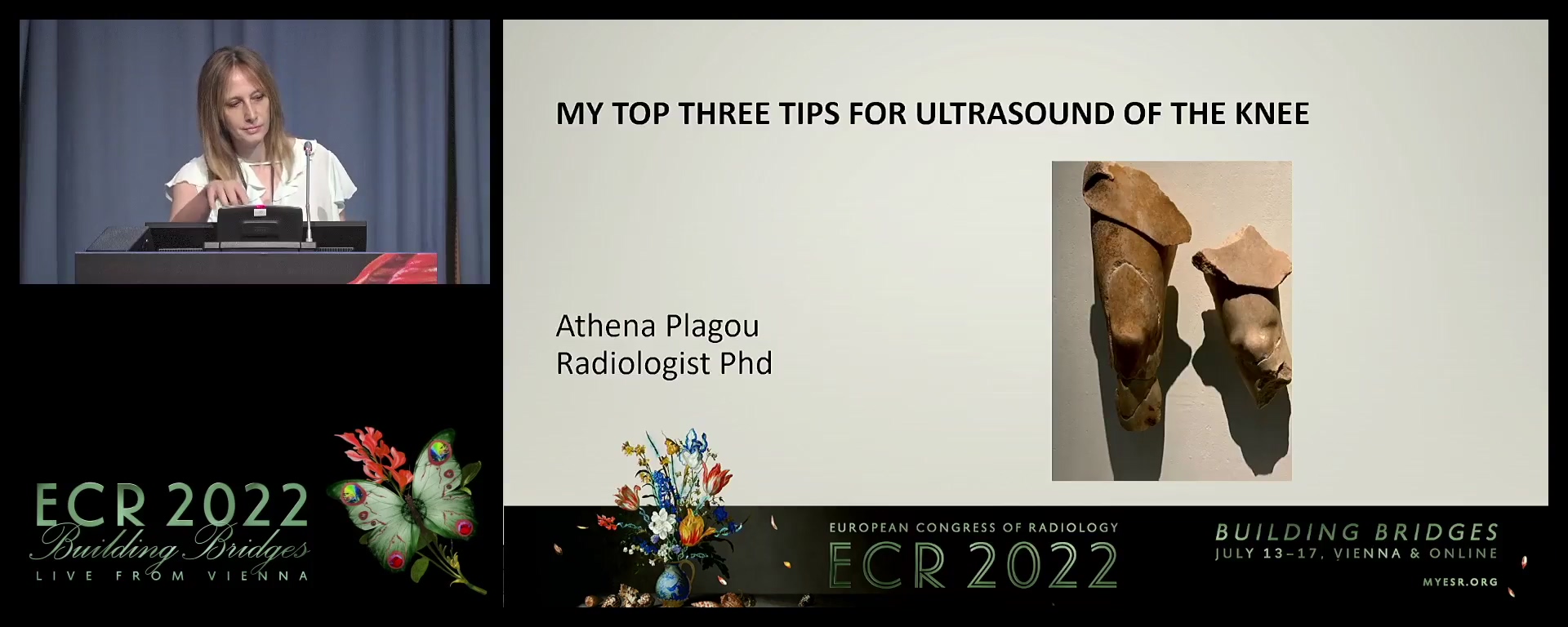 My top three tips for ultrasound of the knee - Athena Plagou, Athens / GR