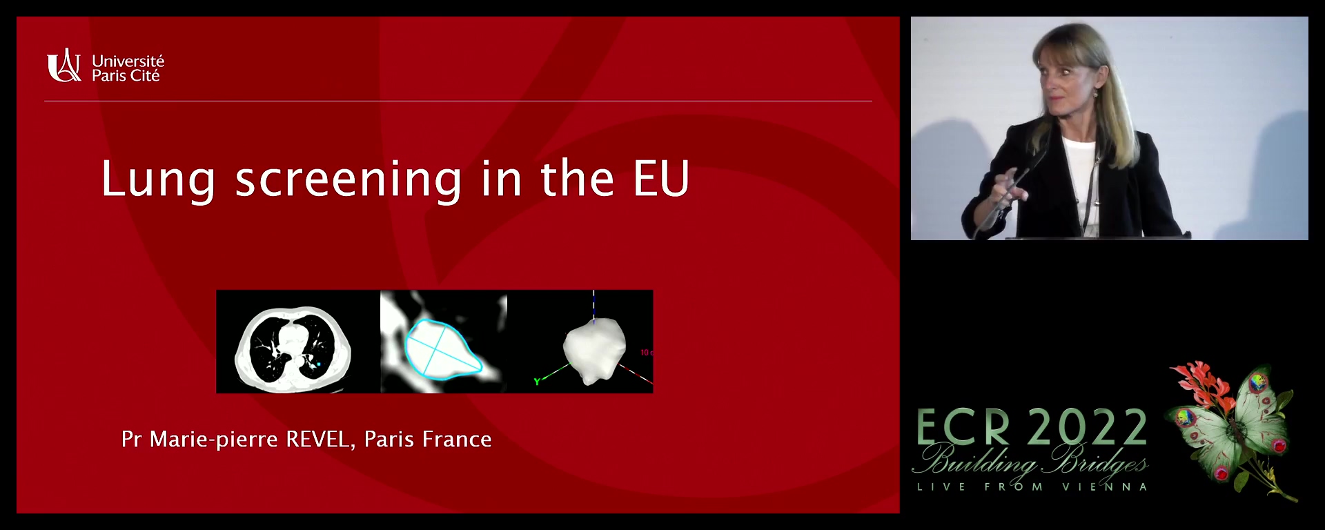 Lung screening in the EU - Marie-Pierre Revel, Paris / FR