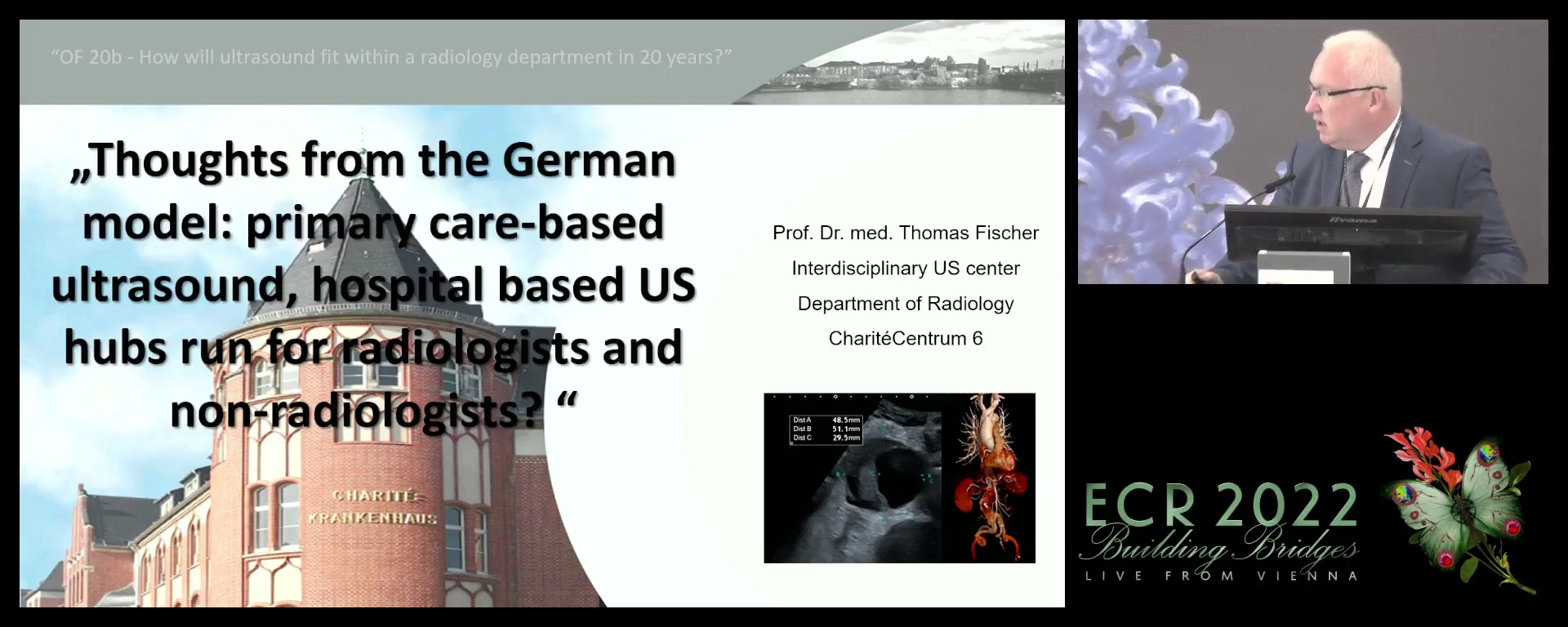 Thoughts from the German model: primary care-based ultrasound, hospital based US hubs run for radiologists and non-radiologists? - Thomas Fischer, Berlin / DE