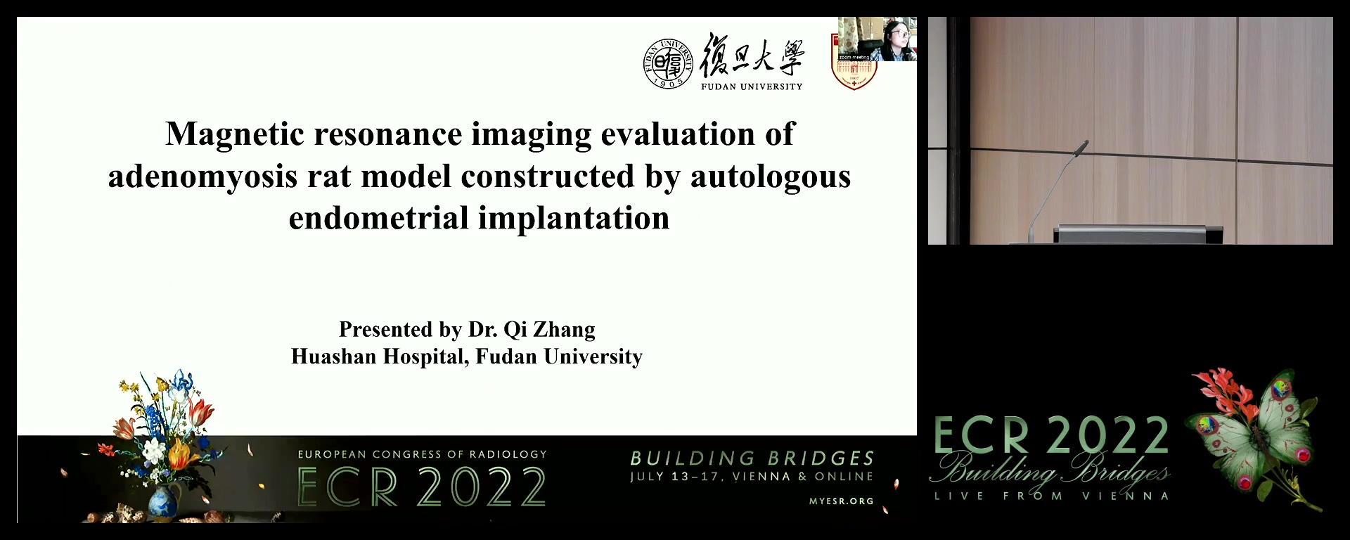 Magnetic resonance imaging evaluation of adenomyosis rat model constructed by autologous endometrial implantation - Qi Zhang, Shanghai / CN