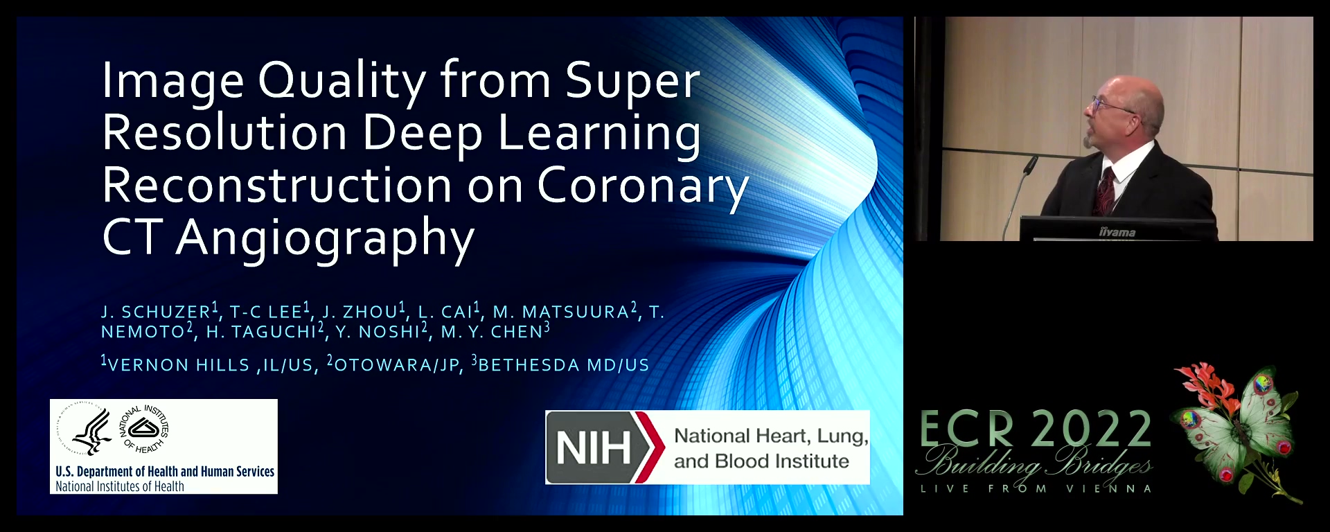 Image quality from super resolution deep learning reconstruction on coronary CT angiography - John Schuzer, Wheaton / US