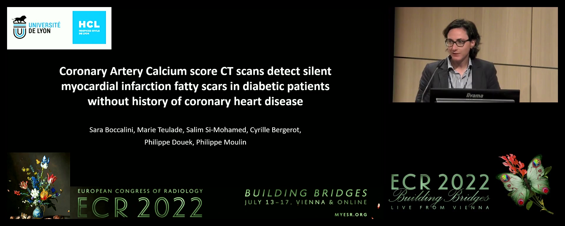 Silent myocardial infarction fatty scars detected by coronary calcium score CT scan in diabetic patients without history of coronary heart disease - Sara Boccalini, Bron / FR