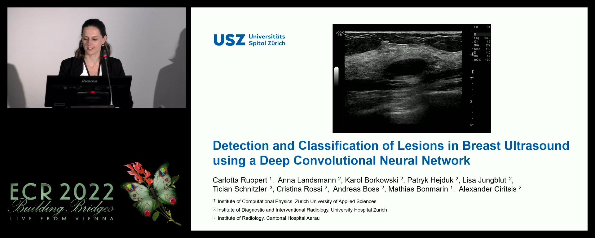 Detection and classification of lesions in breast ultrasound using a deep convolutional neural network