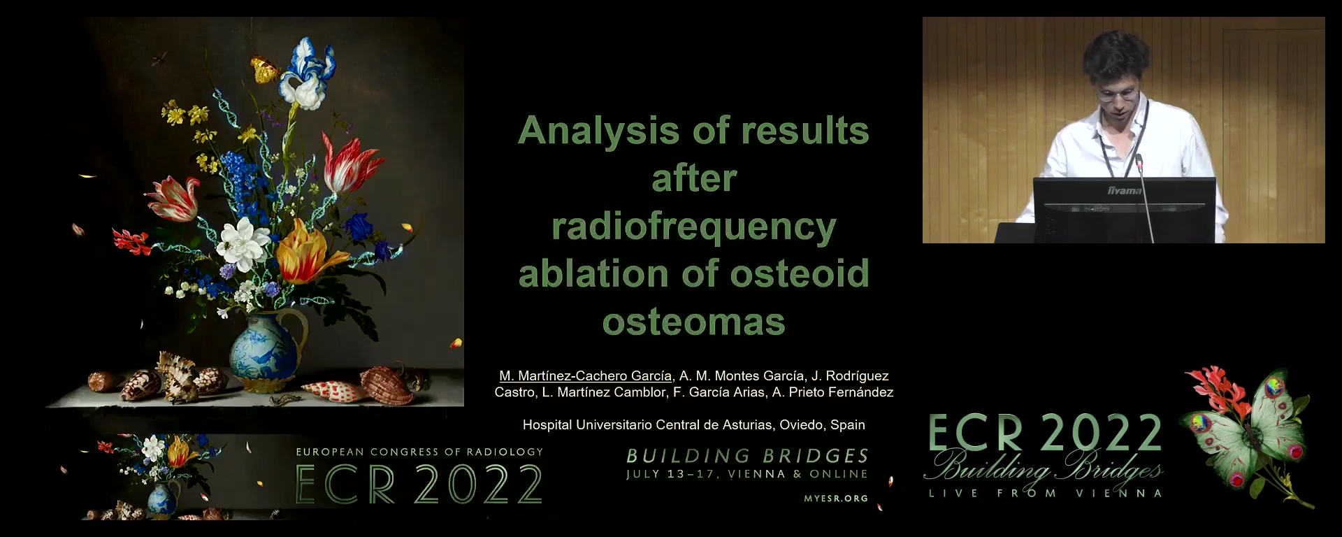 Analysis of results after radiofrequency ablation of osteoid osteomas