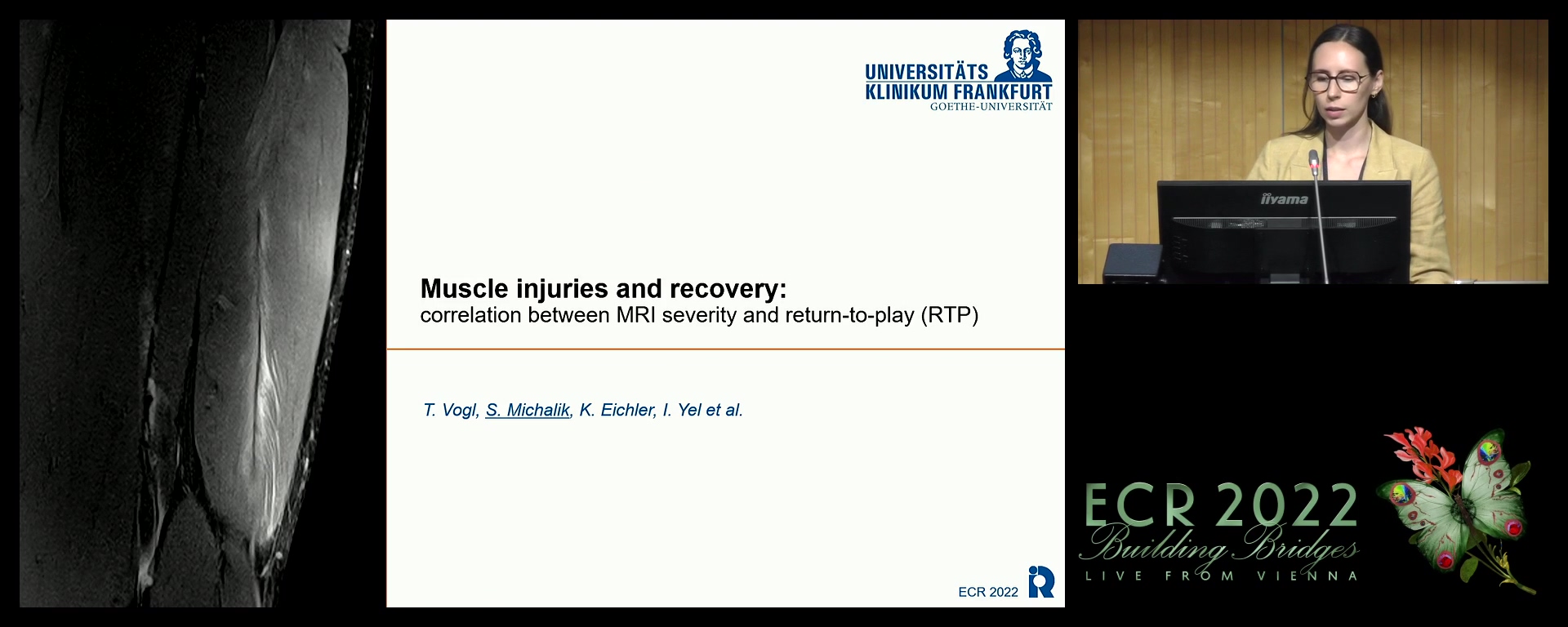 Muscle injuries and recovery: correlation MRI injury severity and return to play (RTP): a prospective study