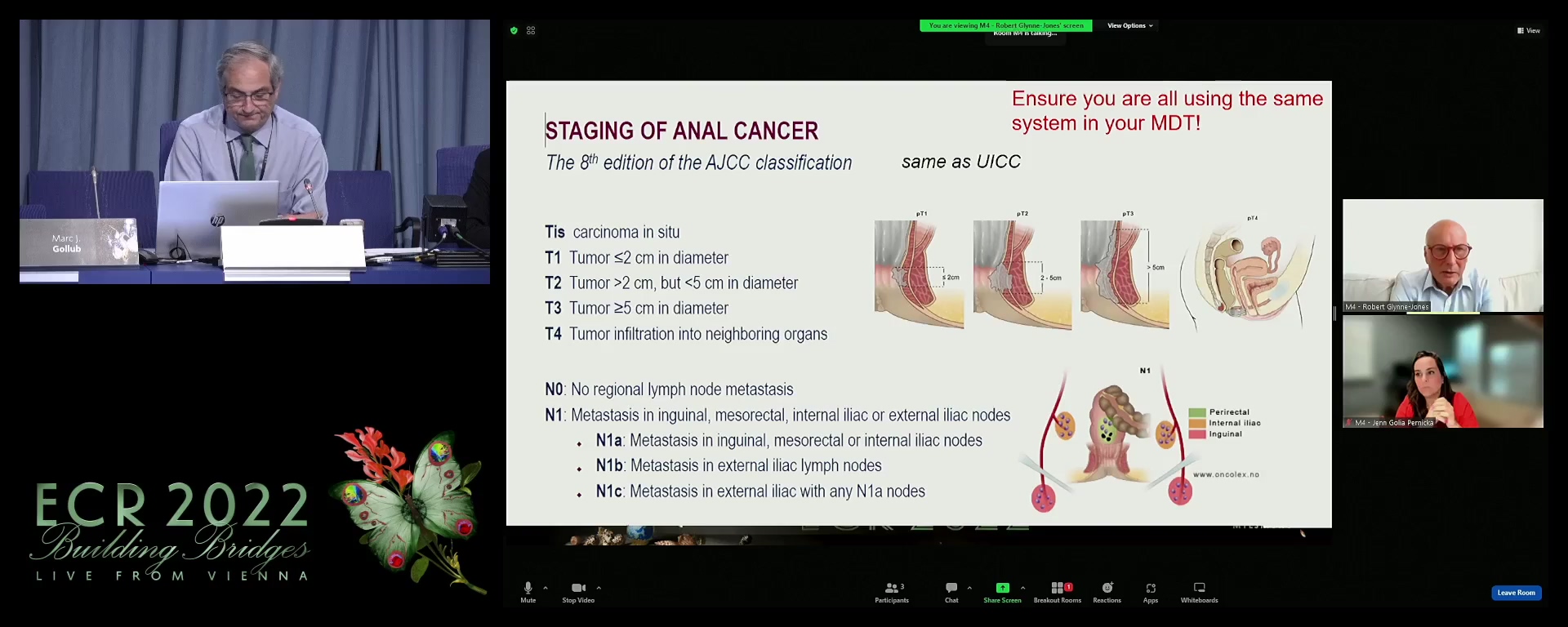 How to manage anal cancer: the radiation oncologist's perspective
