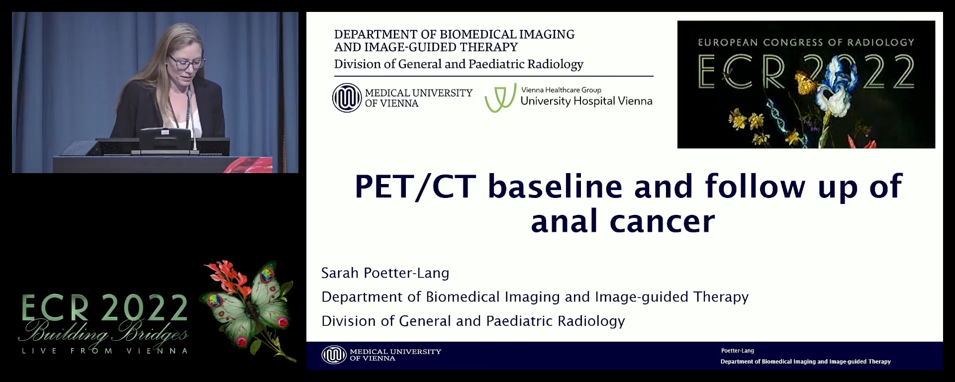 PET/CT baseline and follow up of anal cancer