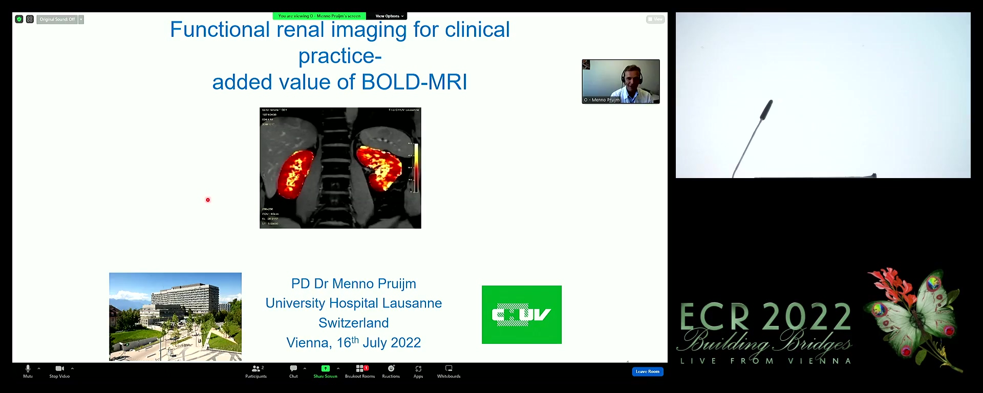 Added value of BOLD MRI