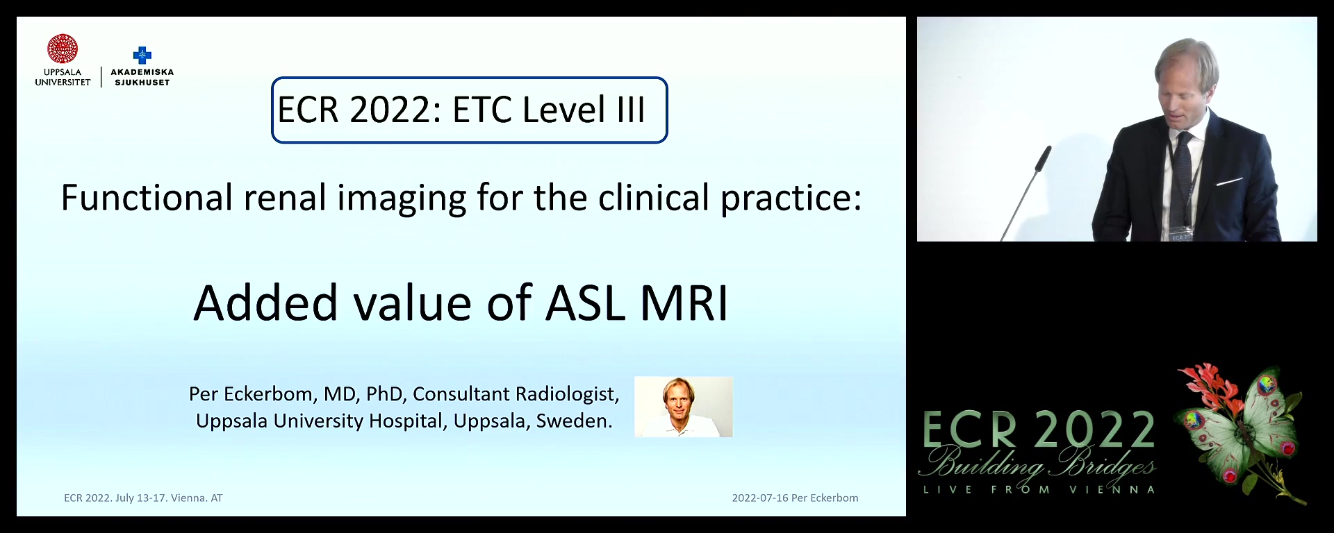 Added value of ASL MRI