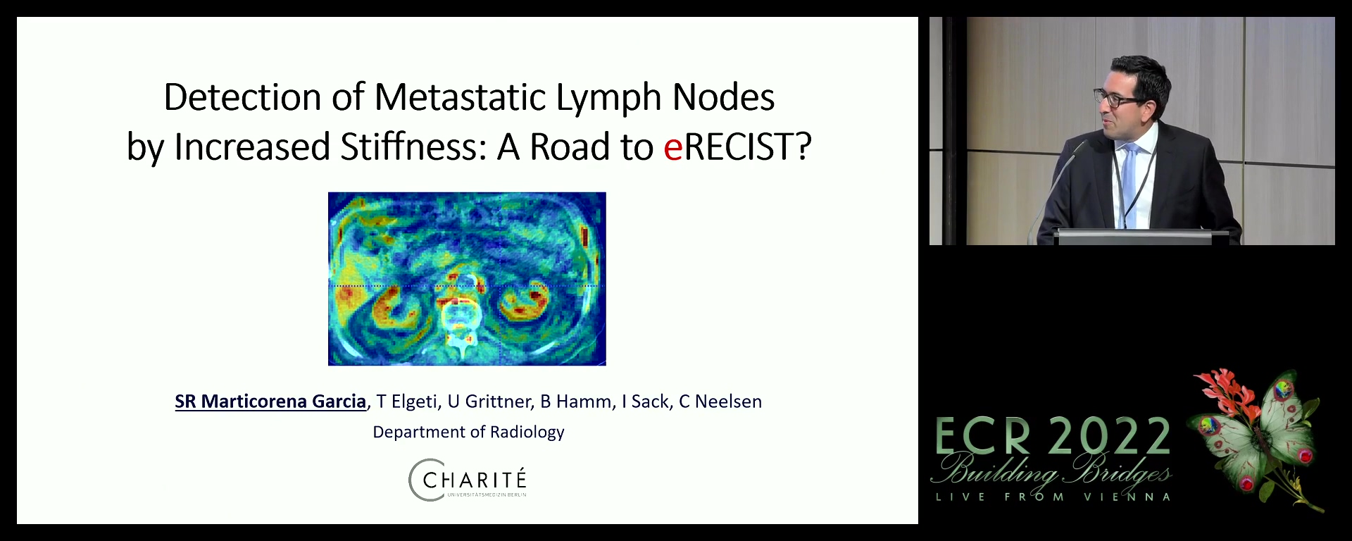 Detection of metastatic lymph nodes by increased stiffness: a road to eRECIST?