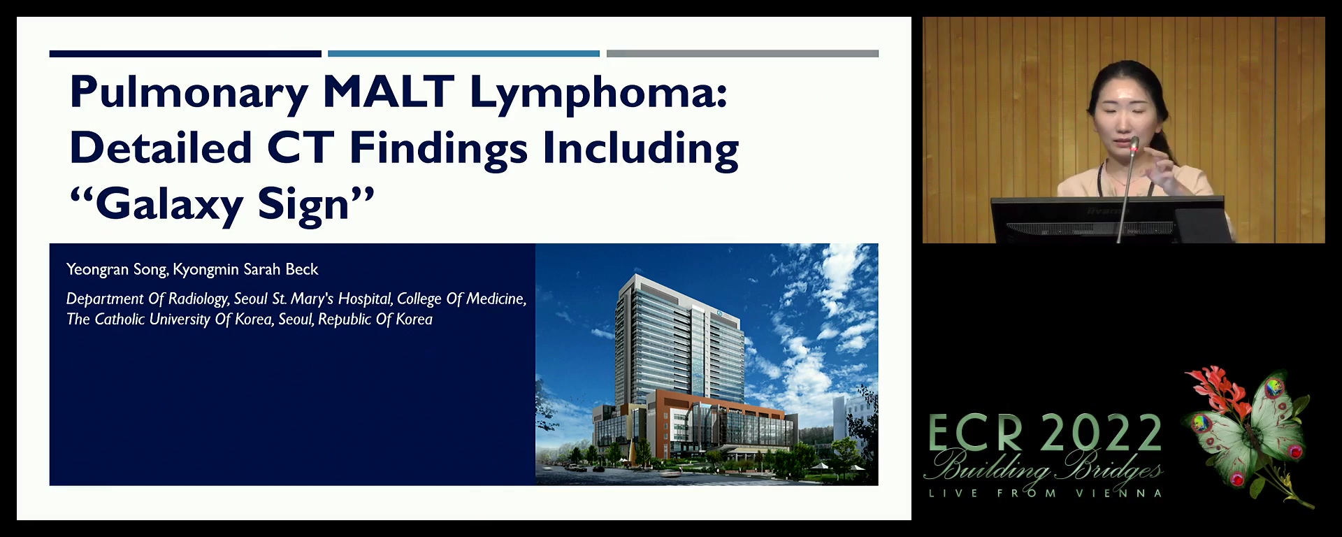 Pulmonary MALT lymphoma: detailed CT findings, including 