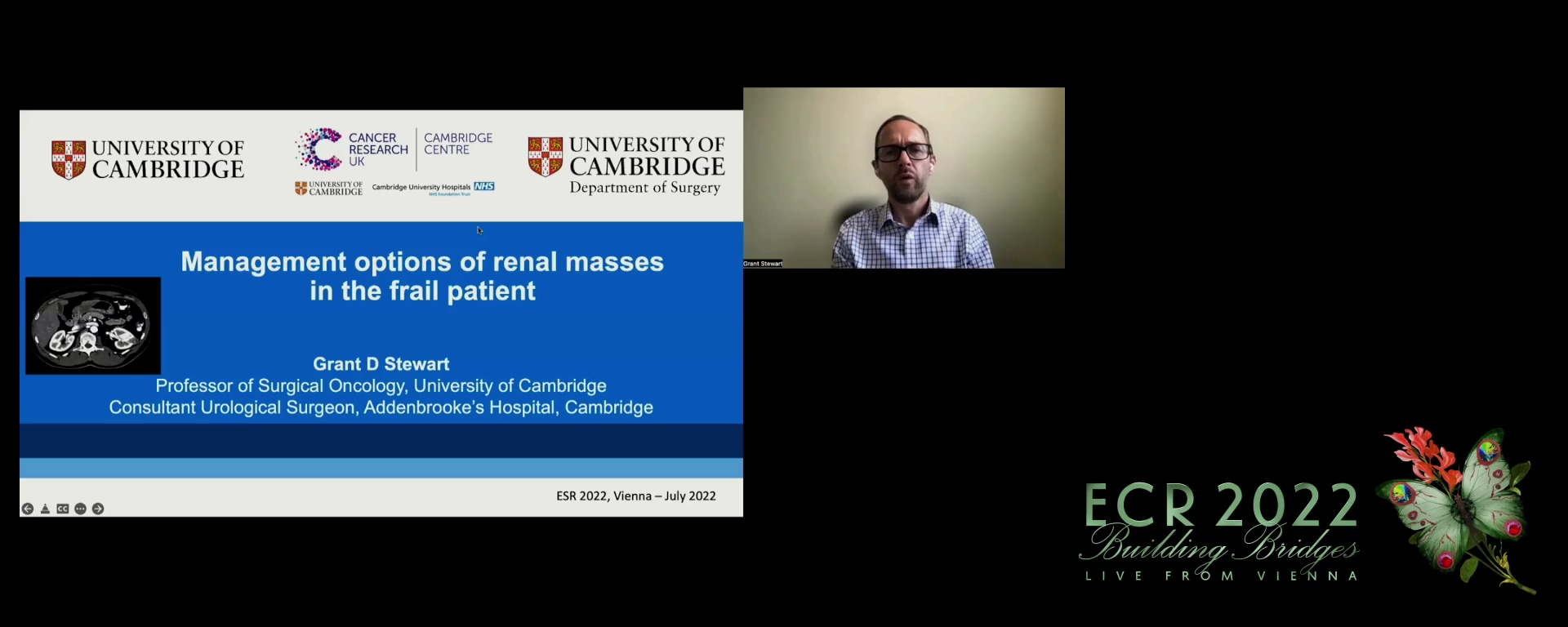 Management options of renal masses in the frail patient - Grant Stewart, Cambridge / UK