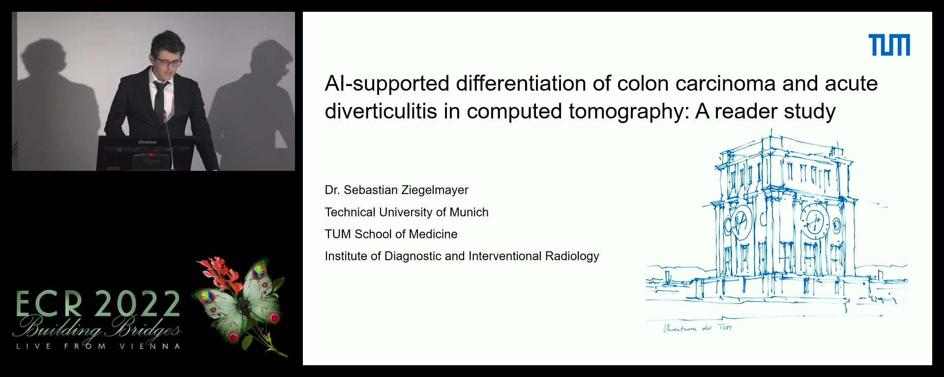 Artificial intelligence support system to improve the diagnostic accuracy of radiologist in differentiating colon carcinoma and diverticulitis in computed tomography - Sebastian Ziegelmayer, München / DE