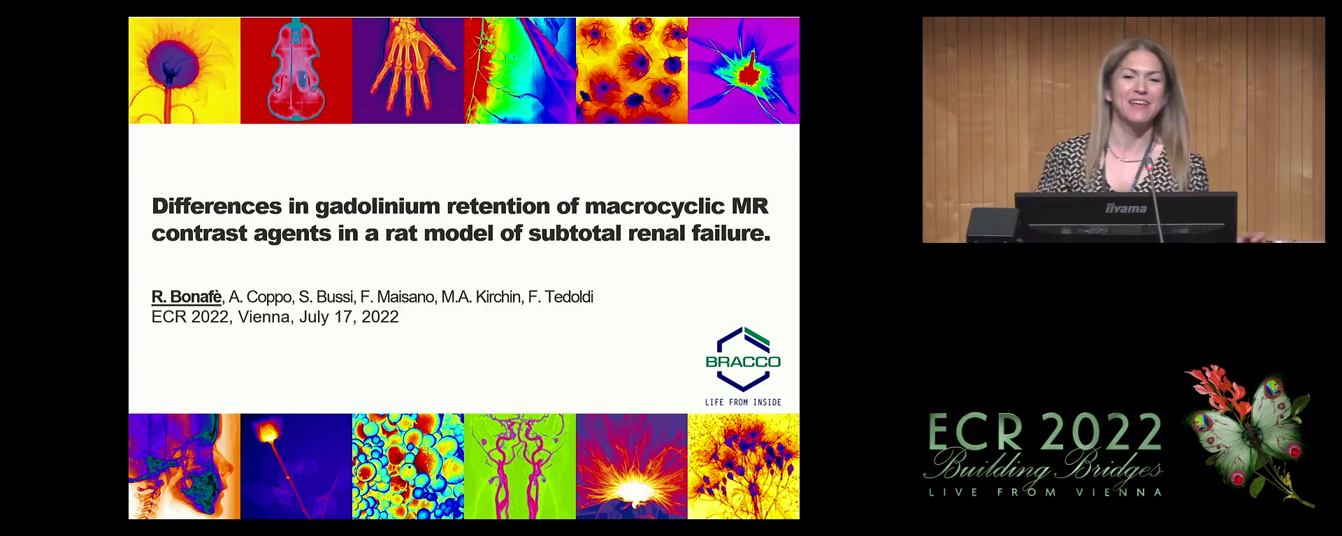 Differences in gadolinium retention of macrocyclic MR contrast agents in a rat model of subtotal renal failure