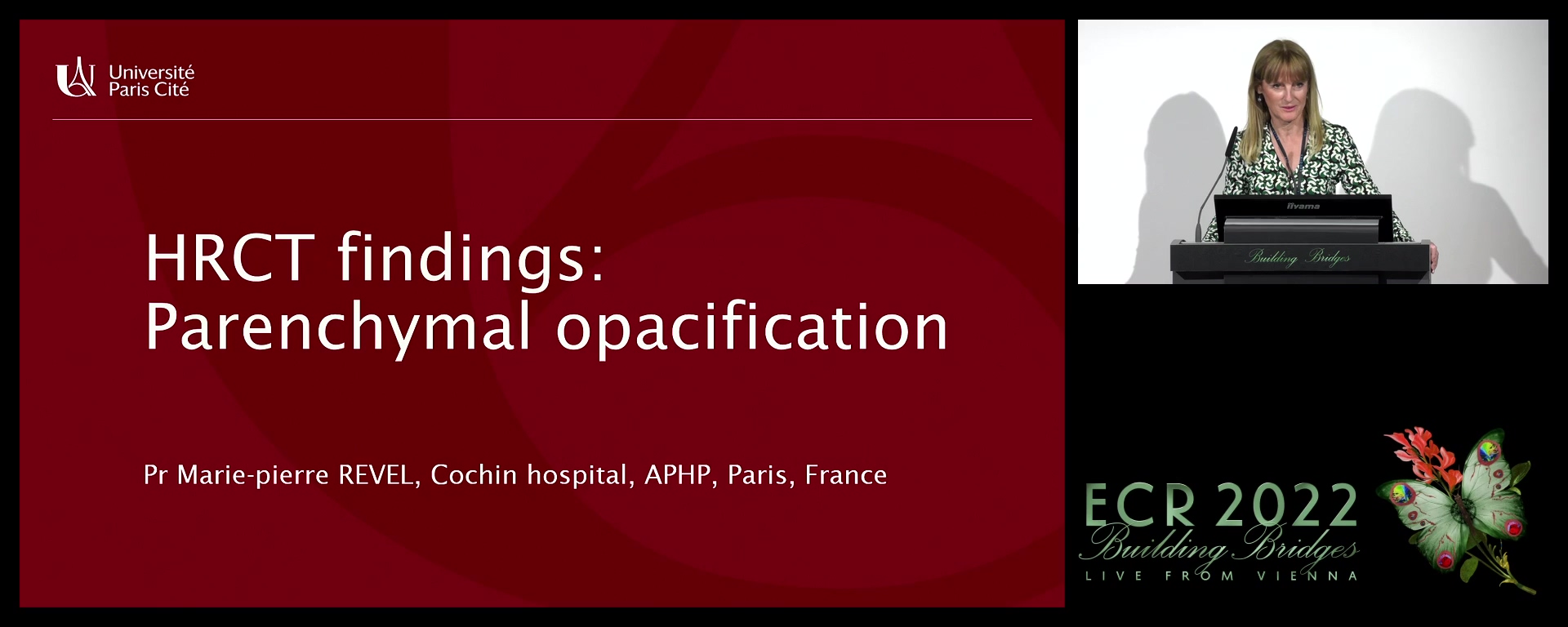 HRCT findings: parenchimal opacification - Marie-Pierre Revel, Paris / FR