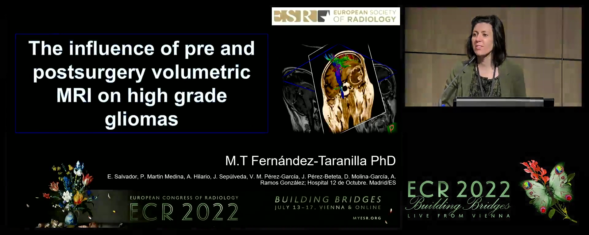 The influence of pre- and postsurgery volumetric MRI on high grade gliomas