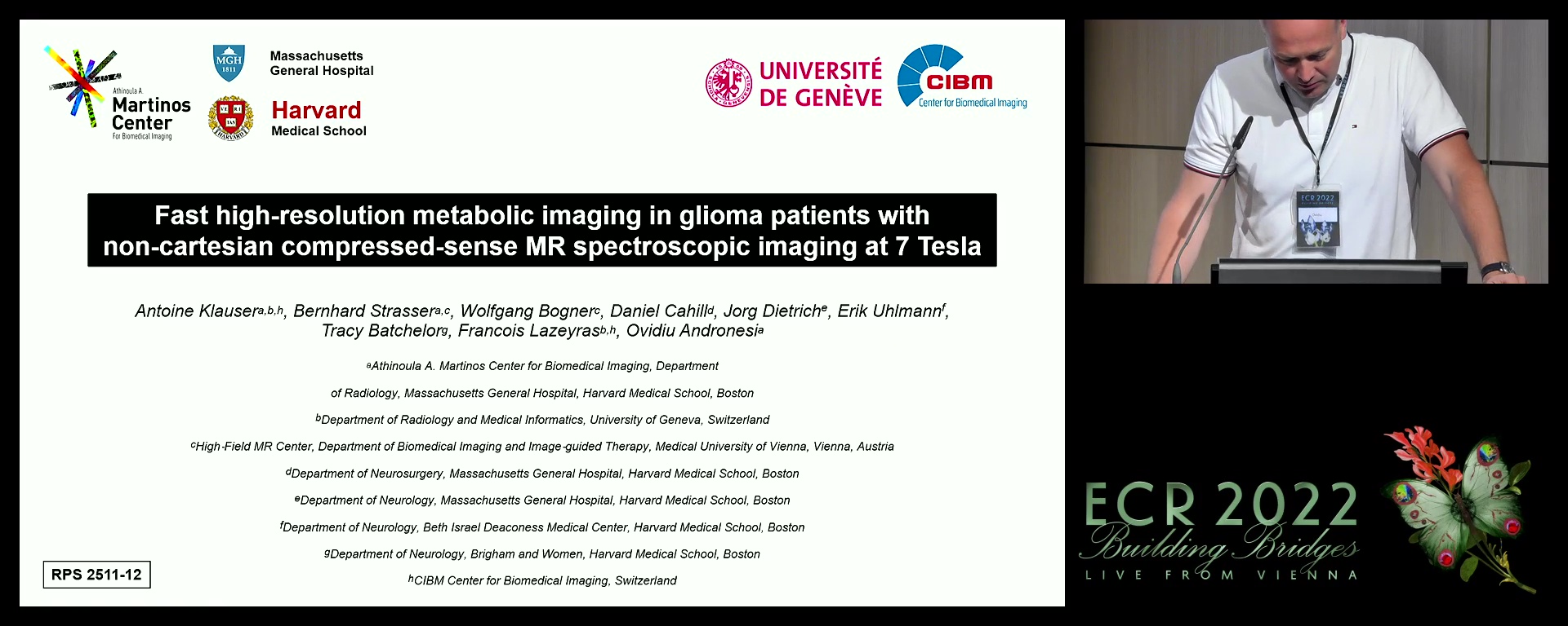 Fast high-resolution metabolic imaging in glioma patients with non-cartesian compressed-sense MR spectroscopic imaging at 7 Tesla