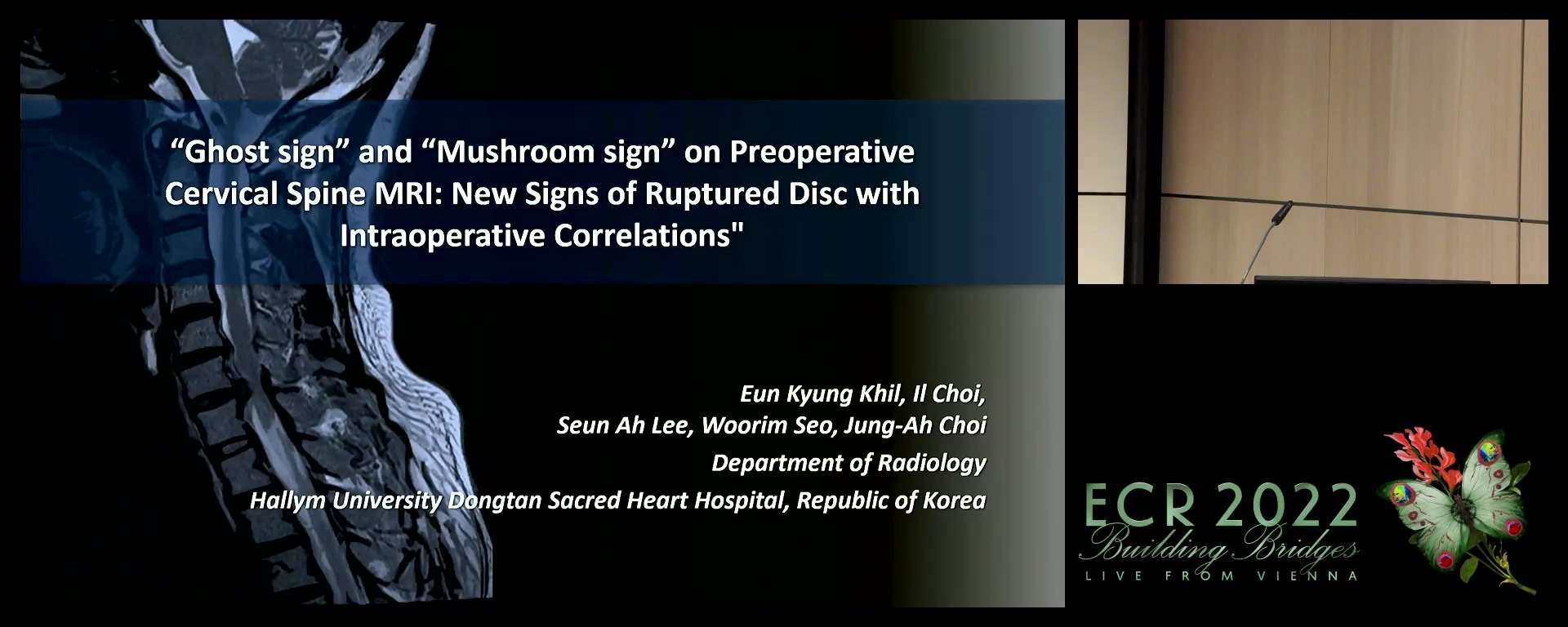 "Ghost sign" and "mushroom sign" on preoperative cervical spine MRI: new signs of ruptured disc with intraoperative correlations