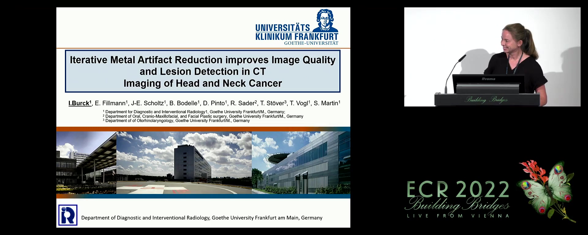 Iterative metal artifact reduction improves image quality and lesion detection in CT imaging of head and neck cancer
