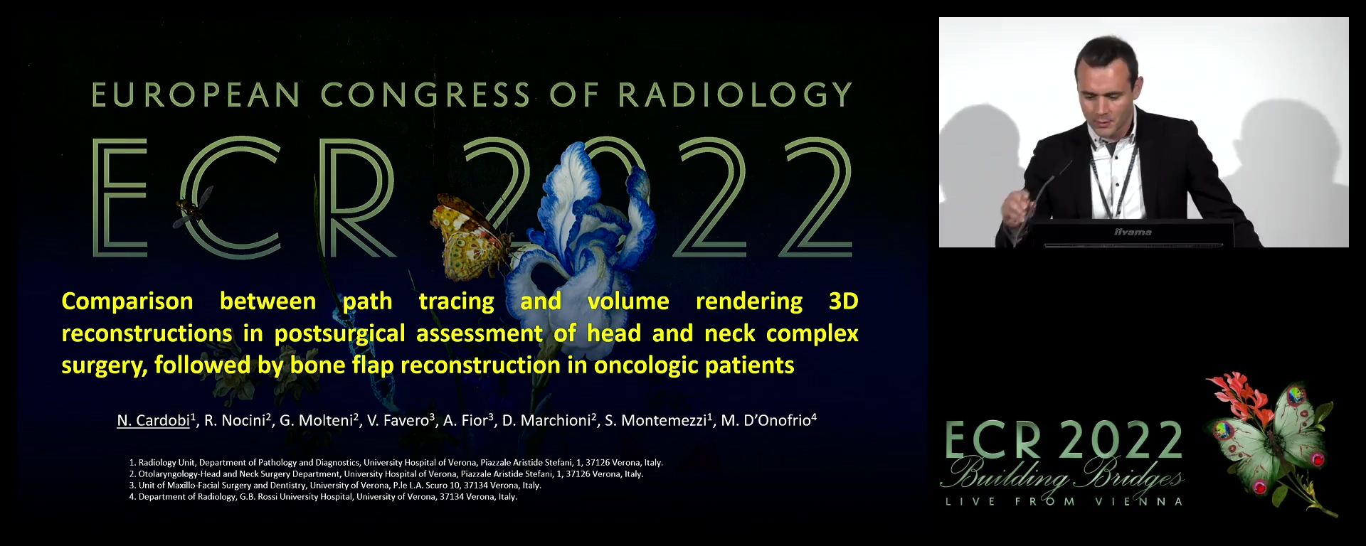 Comparison between path tracing and volume rendering 3D reconstructions in postsurgical assessment of head and neck complex surgery, followed by bone flap reconstruction in oncologic patients
