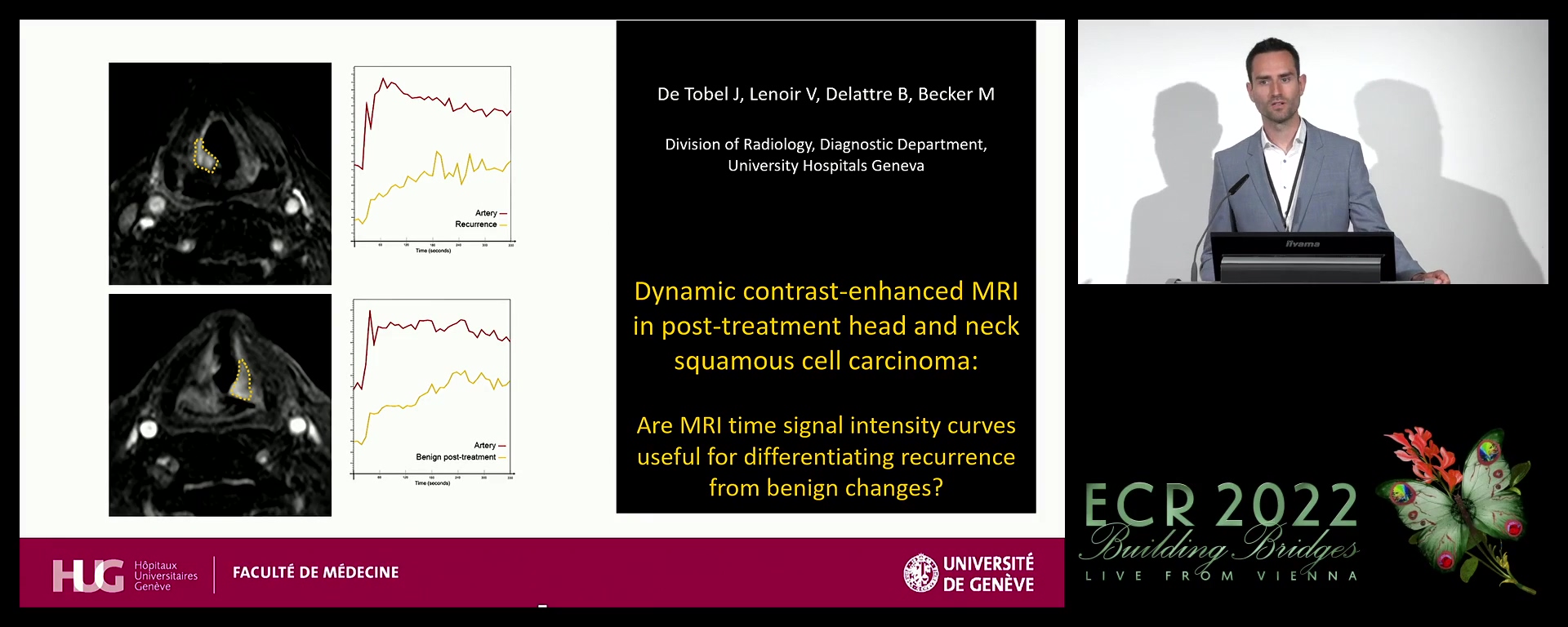 Dynamic contrast-enhanced MRI in post-treatment head and neck squamous cell carcinoma: are MRI time signal intensity curves useful for differentiating recurrence from benign changes?