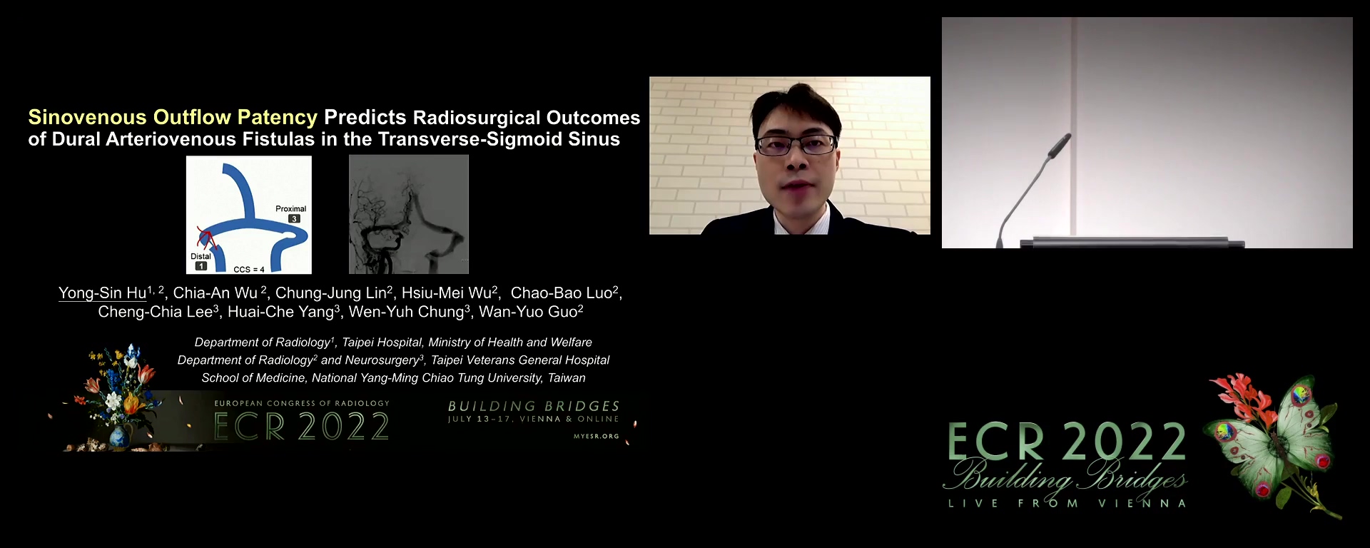 Sinovenous outflow patency predicts radiosurgical outcomes of dural arteriovenous fistulas in the transverse-sigmoid sinus - Yong-Sin Hu, New Taipei / TW