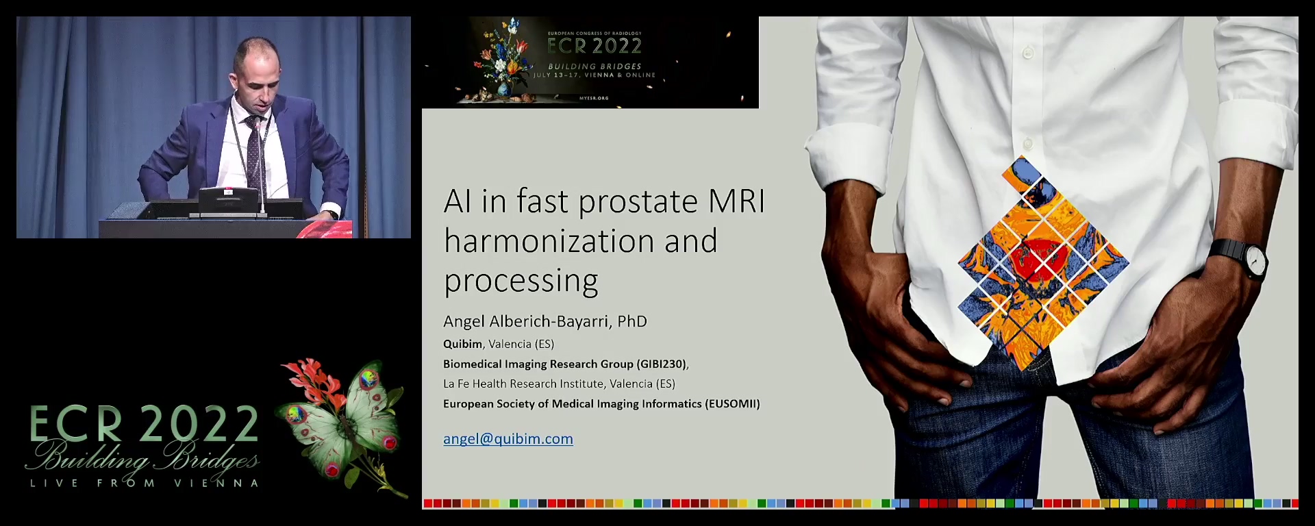 AI in fast prostate MRI harmonization and processing