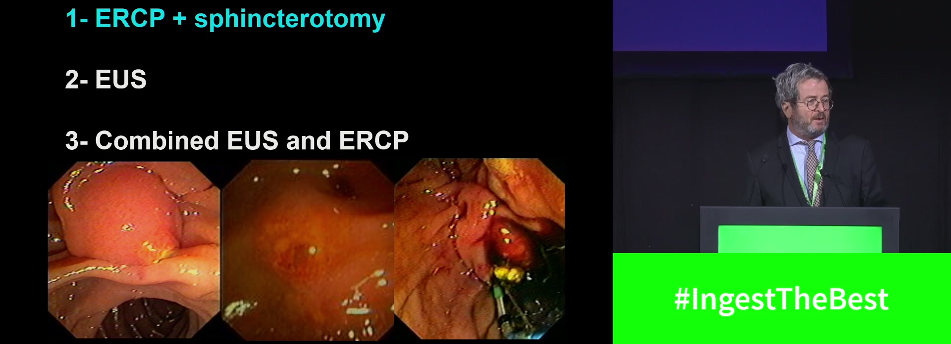 Biliary pancreatitis and endoscopy: When and how?