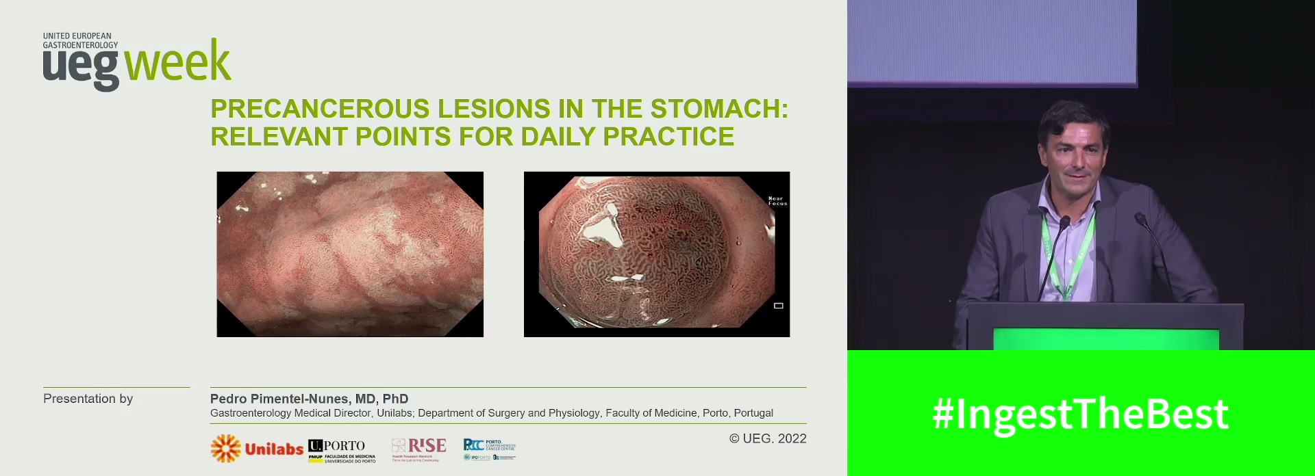 Precancerous lesions in the stomach: Relevant points for daily practice