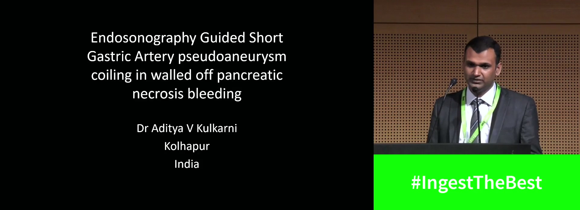 ENDOSONOGRAPHY GUIDED SHORT GASTRIC ARTERY PSEUDOANEURYSM COILING IN WALLED OFF PANCREATIC NECROSIS BLEED
