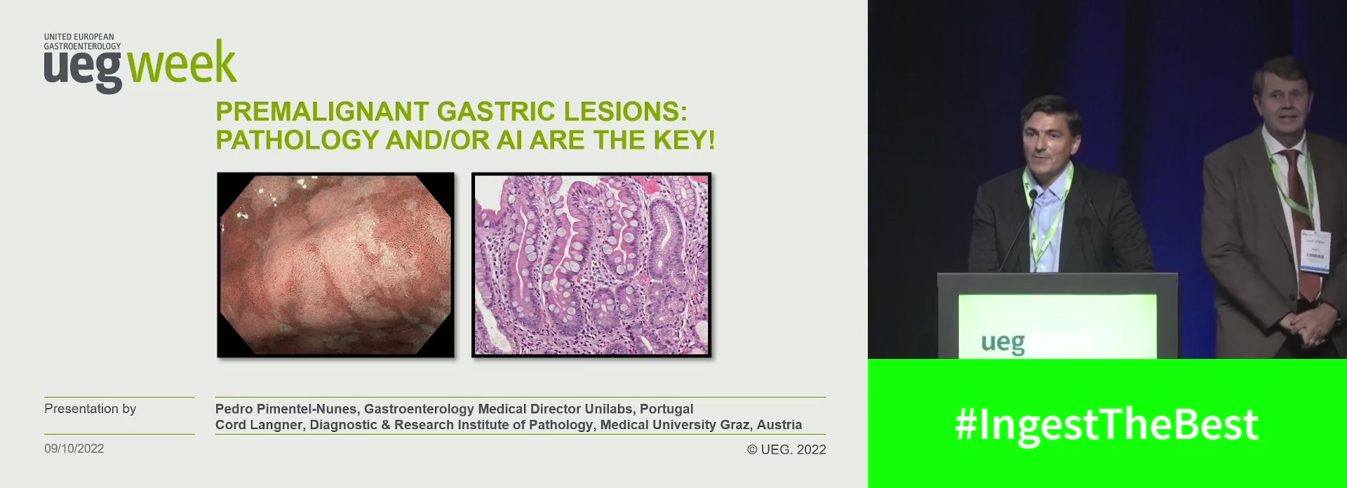 Premalignant gastric lesions: Biopsies are the goldstandard. / AI and machine learning is key