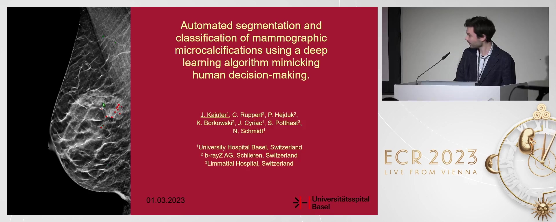 Automated segmentation and classification of mammographic microcalcifications using a deep learning algorithm mimicking human decision-making
