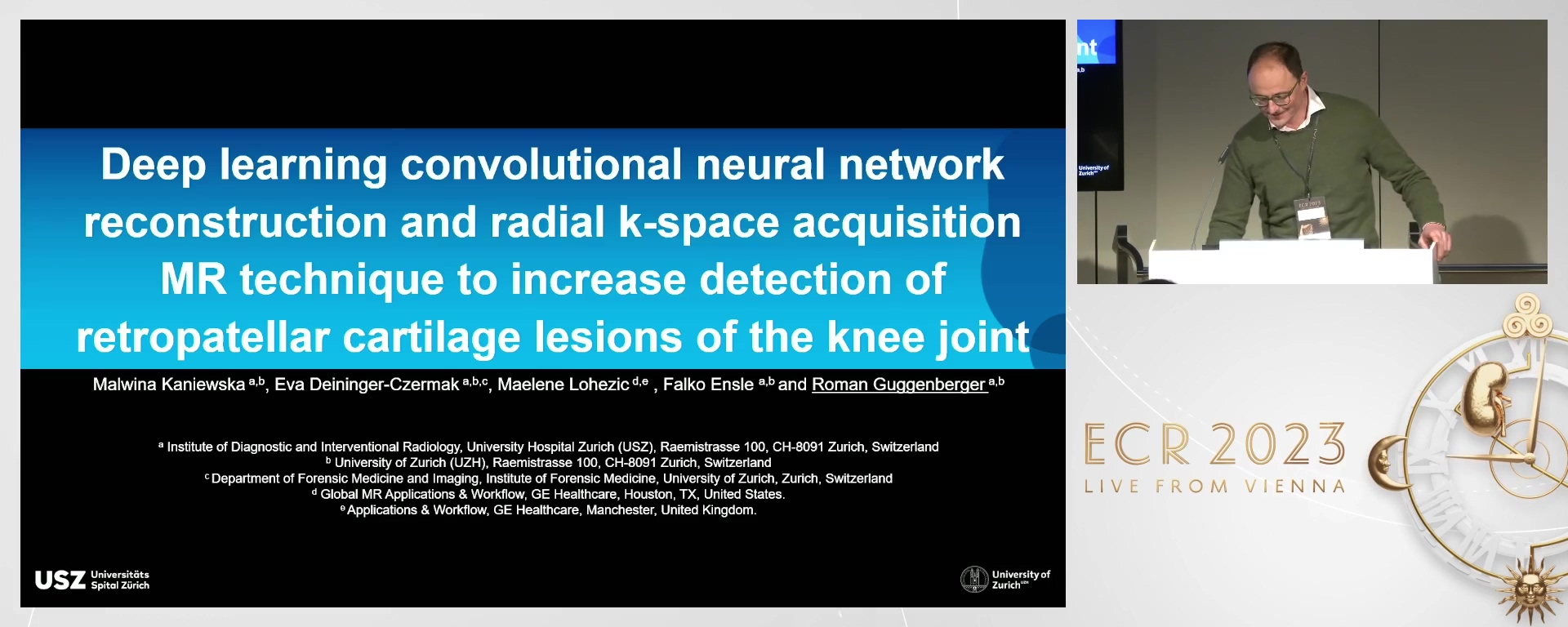 Deep learning convolutional neural network reconstruction and radial k-space acquisition MR technique to increase detection of retropatellar cartilage lesions of the knee joint