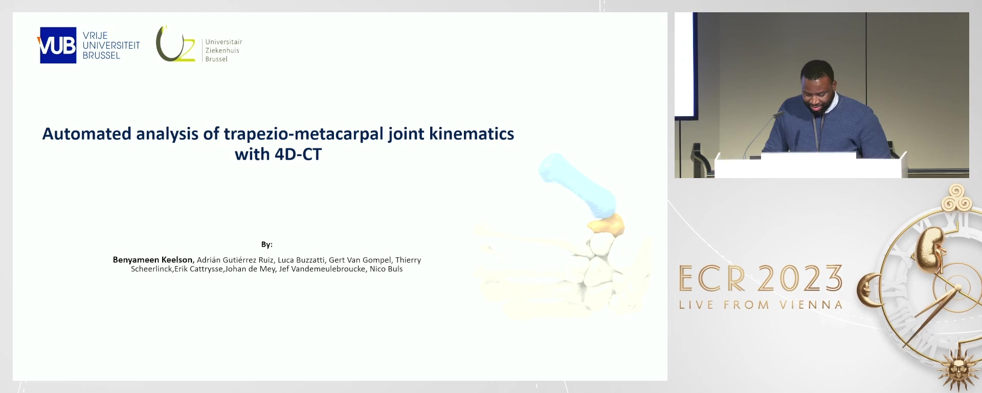 Automated analysis of trapeziometacarpal joint kinematics with 4D-CT