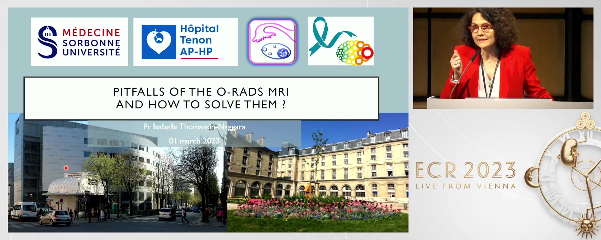 Pitfalls of the O-RADS MRI and how to solve them