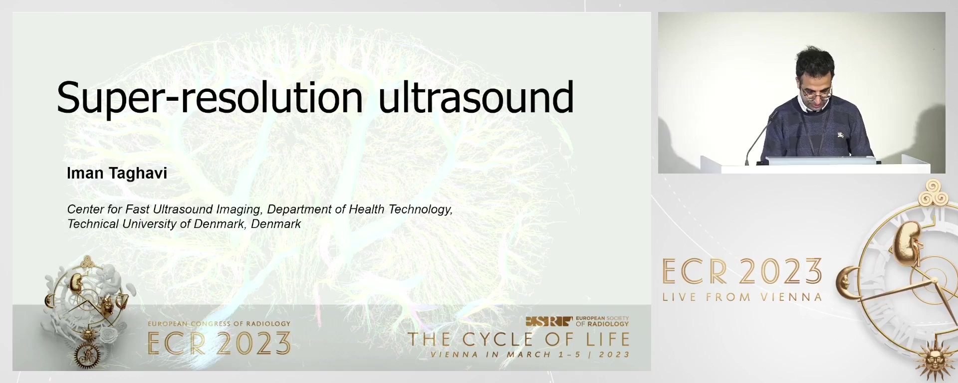 Super-resolution ultrasound imaging