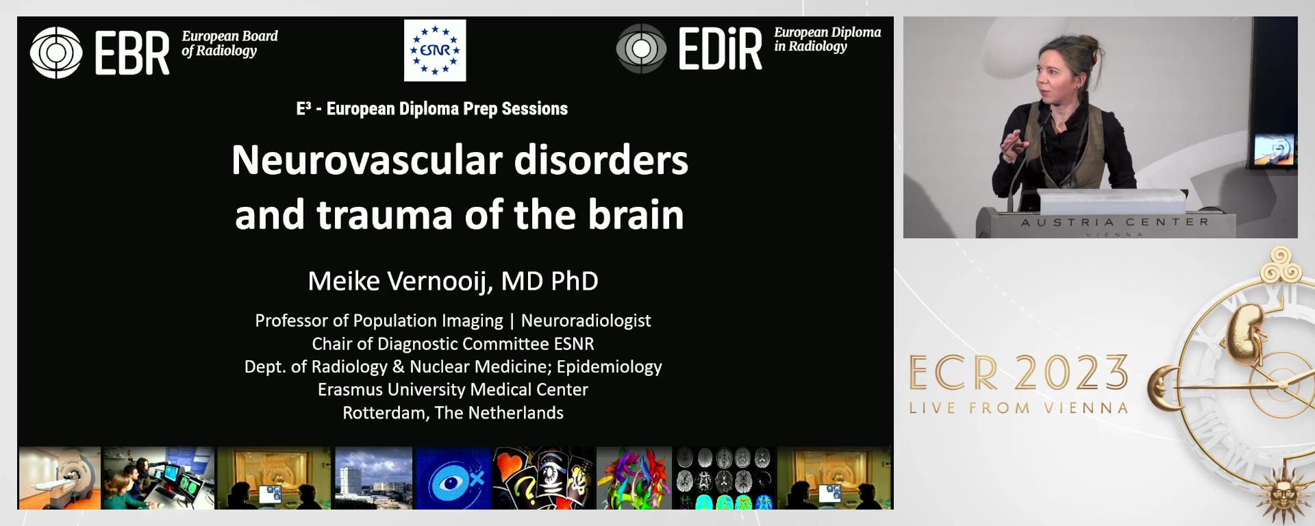 B. Neurovascular disorders and trauma of the brain