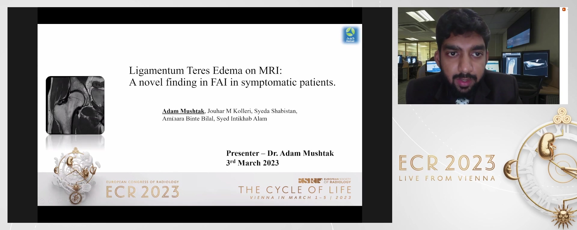 Ligamentum teres oedema: a new marker in the symptomatic cases of femoroacetabular impingement (FAI)