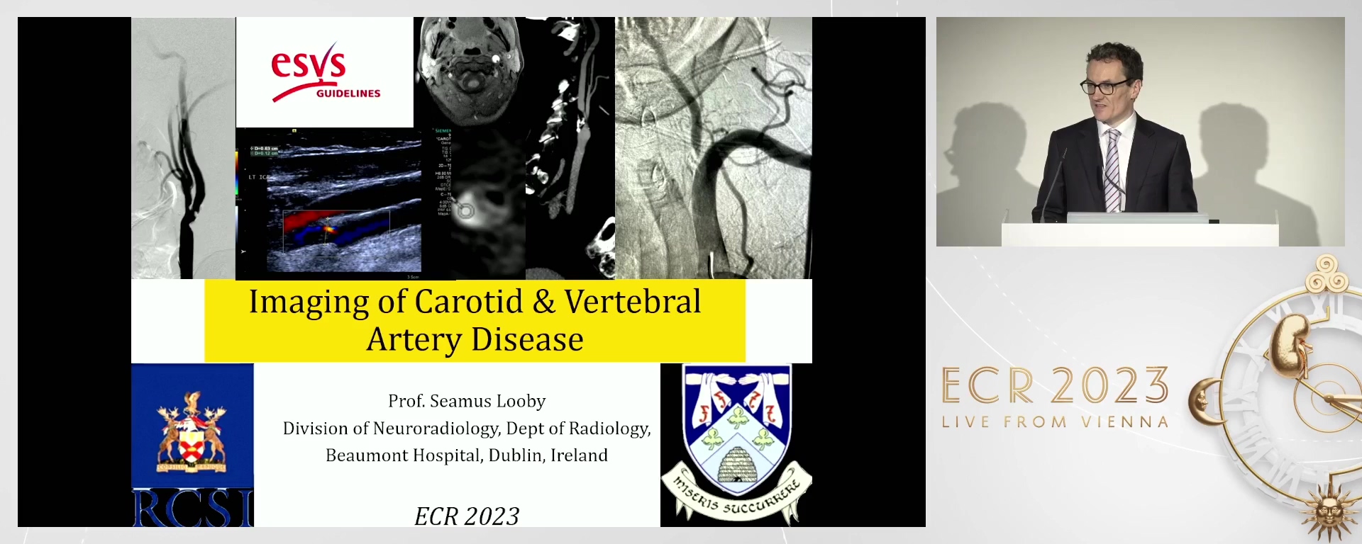 Imaging of internal carotid and vertebral artery disease