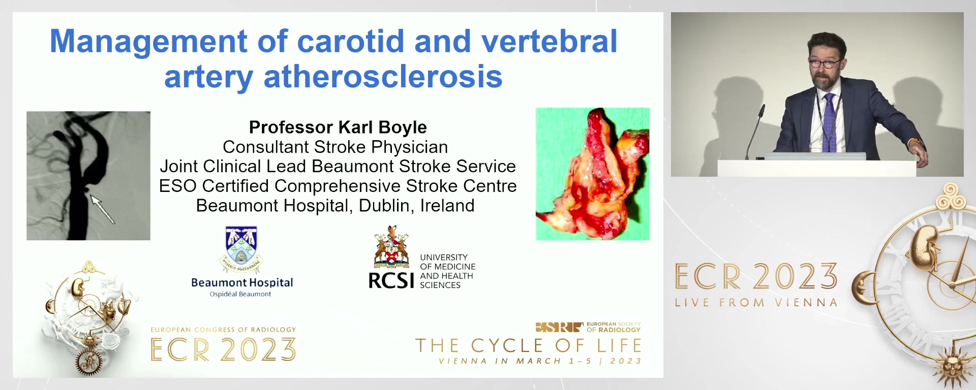 Management of carotid and vertebral artery atherosclerosis